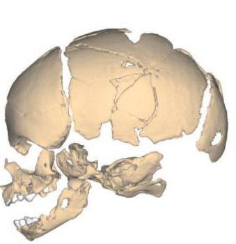 Cranio: articolazione delle ossa del cranio. Tipi di connessione delle ossa del cranio