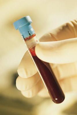 Come ridurre le piastrine nel sangue?